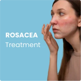 Rosaceabehandling