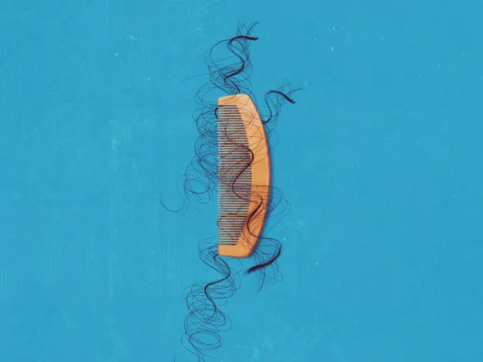 Can You Prevent Hair Loss Before It’s Too Late